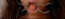 mouth yoke